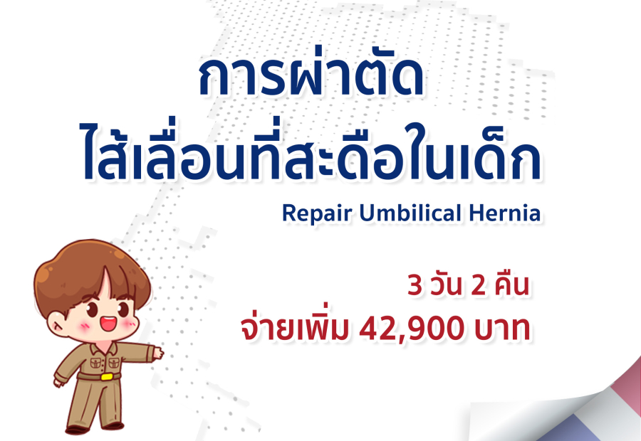 การผ่าตัดไส้เลื่อนที่สะดือในเด็ก